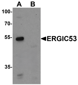 LMAN1 Antibody
