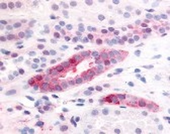 PDGFRB Antibody