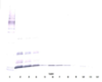 Il7 Antibody