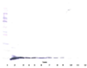 beta-NGF Antibody