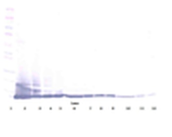Eotaxin (CCL11) Antibody