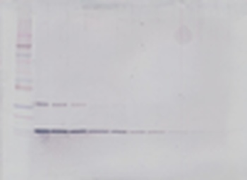 GM-CSF Antibody