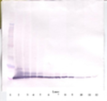 Eotaxin (CCL11) Antibody