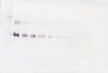 IL2RA Antibody (Biotin)