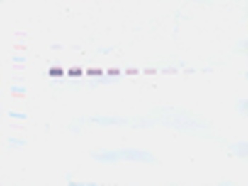 IL1B Antibody