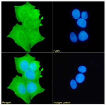 FOXP1 Antibody [RAB-S37], Rabbit IgG
