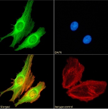 FOXP4 Antibody [RAB-S40], Rabbit IgG