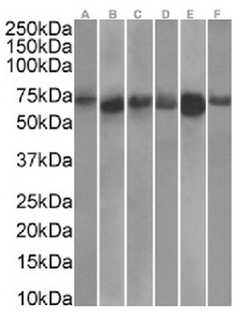 TDRD3 Antibody [RAB-C419], Rabbit IgG