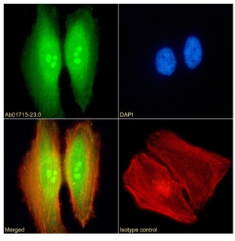 TDRD3 Antibody [RAB-C419], Rabbit IgG