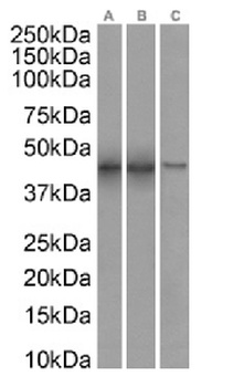 SETD7 Antibody [RAB-C220], Rabbit IgG