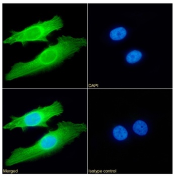 SETD7 Antibody [RAB-C220], Rabbit IgG