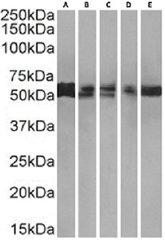 PRMT3 Antibody [RAB-C372], Rabbit IgG