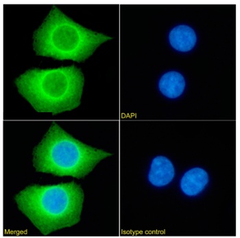 PRDM9 Antibody [RAB-C370], Rabbit IgG