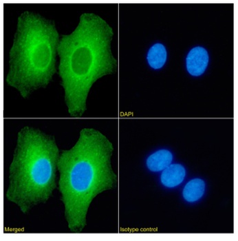 L3MBTL1 Antibody [RAB-C213], Rabbit IgG
