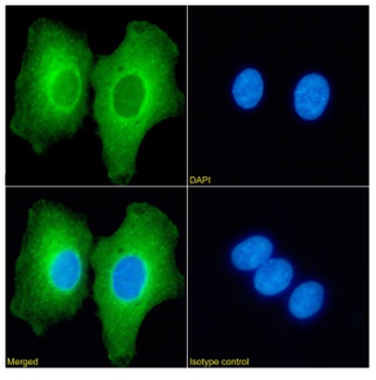 L3MBTL1 Antibody