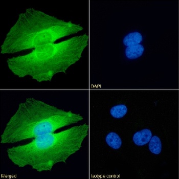 PRMT5 Antibody [RAB-C136], Rabbit IgG