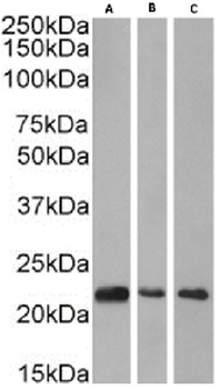 CBX1 Antibody