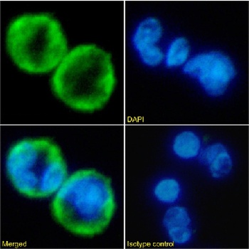 IL-8RA Antibody [SE2], Rabbit IgG