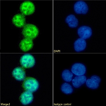 CCR5 (phosphoserine 337) Antibody [V14/2], Rabbit IgG