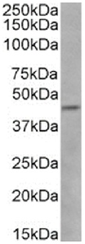 CCR5 (phosphoserine 337) Antibody [V14/2], Rabbit IgG