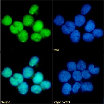 CCR5 (phosphoserine 349) Antibody [E11/19], Rabbit IgG