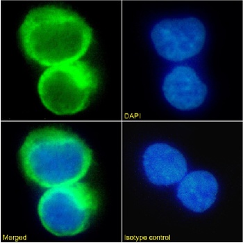 CCR5 Antibody [T21/8], Rabbit IgG