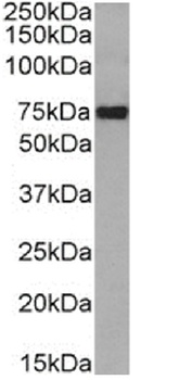 CD36 Antibody [185-1G2 (B467)], Rabbit IgG