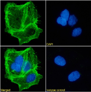 EpCAM Antibody [HEA125], Mouse IgG1