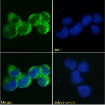 IL9R Antibody