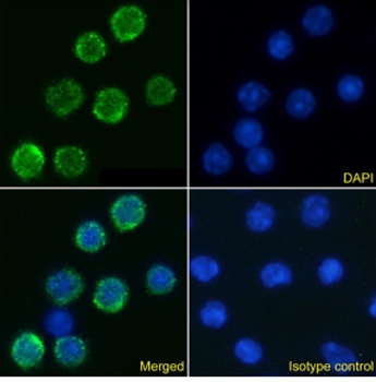 IL-6R Antibody [D7715A7], Rabbit IgG