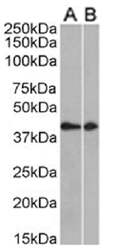CCRL2 Antibody [BZ5B8], Rabbit IgG