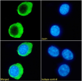 HVEM Antibody [HMHV-1B18], Rabbit IgG