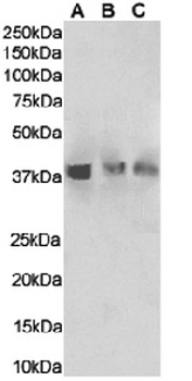 HVEM Antibody [HMHV-1B18], Rabbit IgG