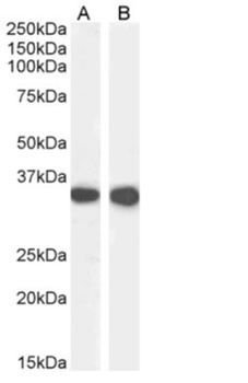 CD74 Antibody [In-1], Rabbit IgG