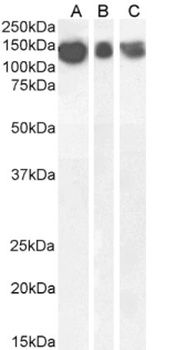 amyloid beta Antibody [6E10], Rabbit IgG