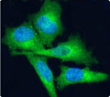 FN1 Antibody
