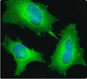 FN1 Antibody