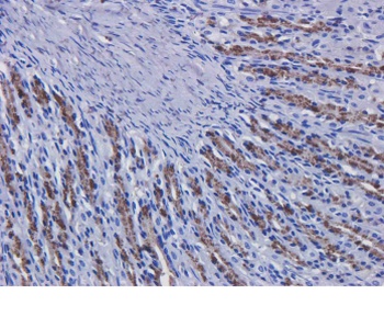 C3 Biosimilar Antibody