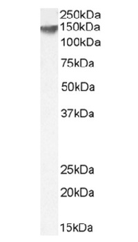 ERBB2 Antibody