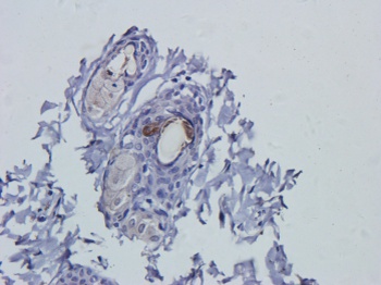VEGF Antibody [A.4.6.1], Mouse IgG1