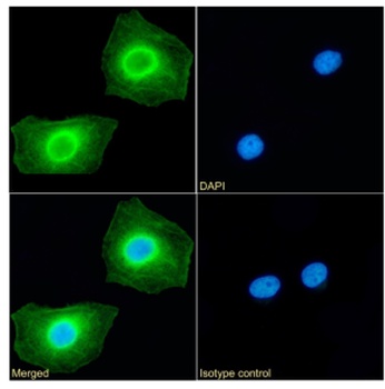 RRM2 Antibody [SAIC-30C-18], Rabbit IgG