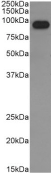 IgM Antibody [M15/8], Rabbit IgG