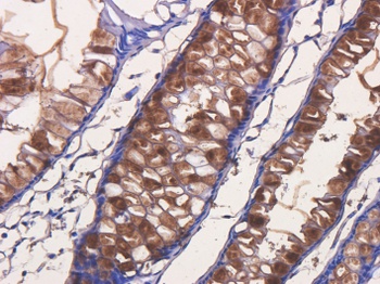 Tumor associated glycoprotein (TAG) 72 Antibody [B72.3 (Satumomab)], Mouse IgG1 - Research Grade Biosimilar