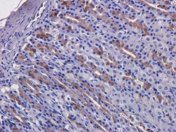 EGFR Antibody [C225 (Cetuximab)], Human IgG1 - Research Grade Biosimilar