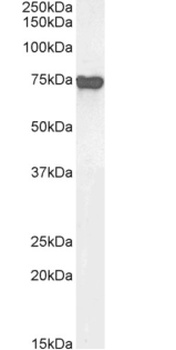 Alpha-fetoprotein (AFP) Antibody [AF5], Rabbit IgG