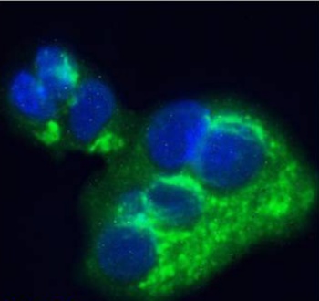 Alpha-fetoprotein (AFP) Antibody [AF5], Rabbit IgG