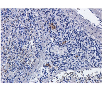 IL-2R alpha (CD25) Antibody [Basiliximab], Human IgG1 - Research Grade Biosimilar