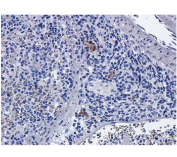 FAS Biosimilar Antibody