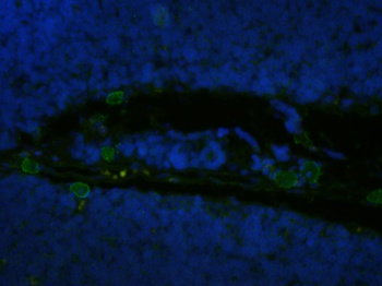 IL-2R alpha (CD25) Antibody [Basiliximab], Human IgG1 - Research Grade Biosimilar