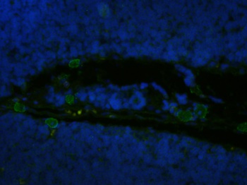 FAS Biosimilar Antibody